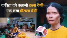 inspiring story of acid attack victim kavita bisht